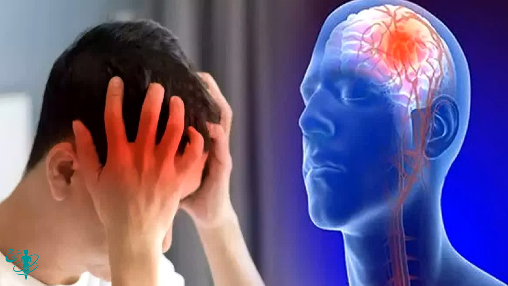 پیشگیری از سکته مغزی